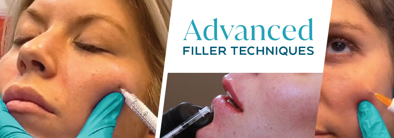 Advanced Filler Techniques