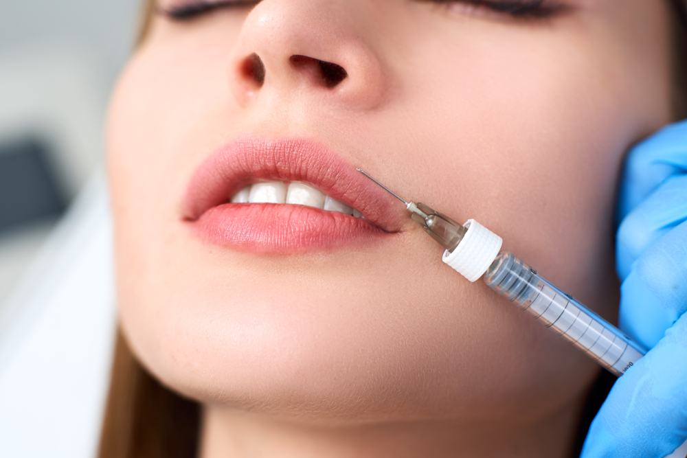 Dermal Fillers Lips